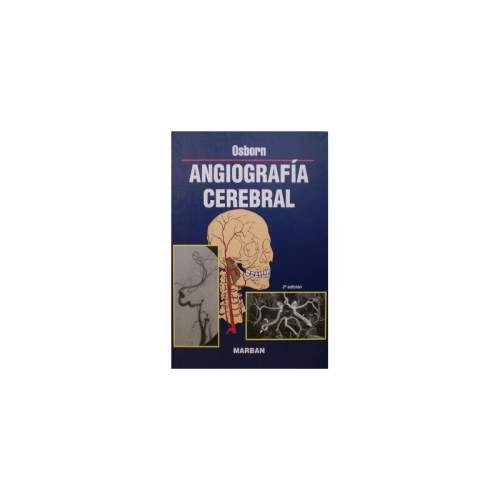 ANGIOGRAFIA CEREBRAL