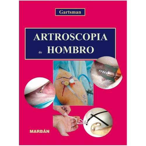 ARTROSCOPIA DEL HOMBRO