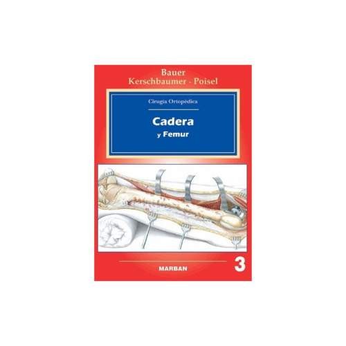 CIRUGIA ORTOPEDICA 3 CADERAYFEMUR""
