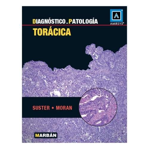 DIAGNOSTICO EN PATOLOGIA TORACICA