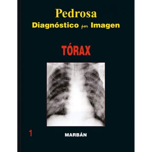 DIAGNOSTICO POR IMAGEN TORAX -GRAN FORMATO-