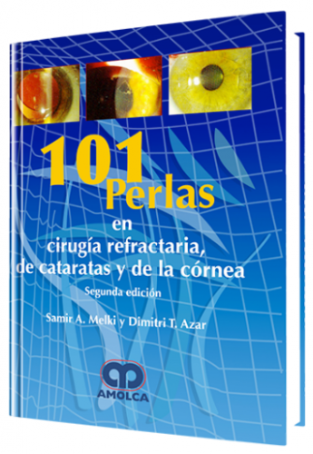 101 Perlas en Cirugía Refractaria de Catarátas y Cornea