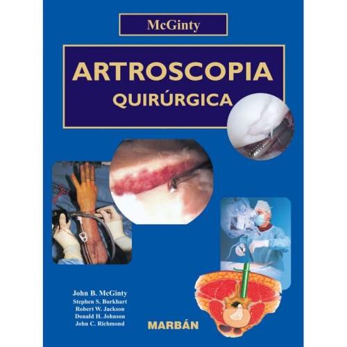 ARTROSCOPIA QUIRURGICA