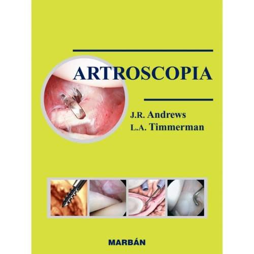 ARTROSCOPIA