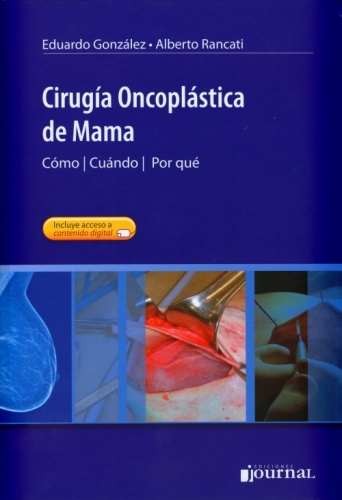 CIRUGIA ONCOPLASTICA MAMA 2013