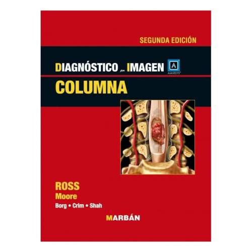DIAGNOSTICO POR IMAGEN COLUMNA AMIRSYS"(ROJO)"