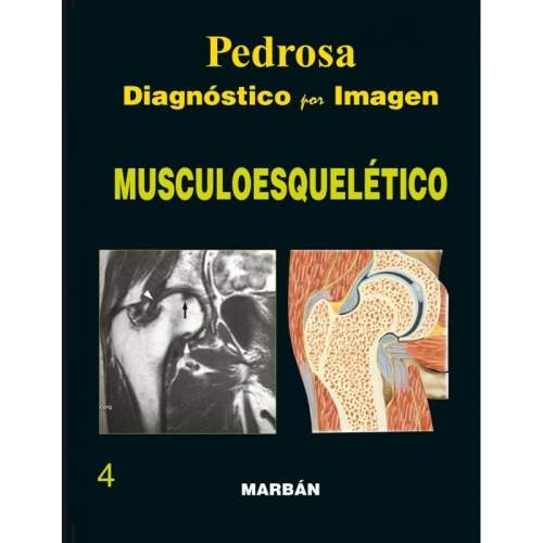 DIAGNOSTICO POR IMAGEN MUSCULOESQUELETICO FLEXILIBRO 21