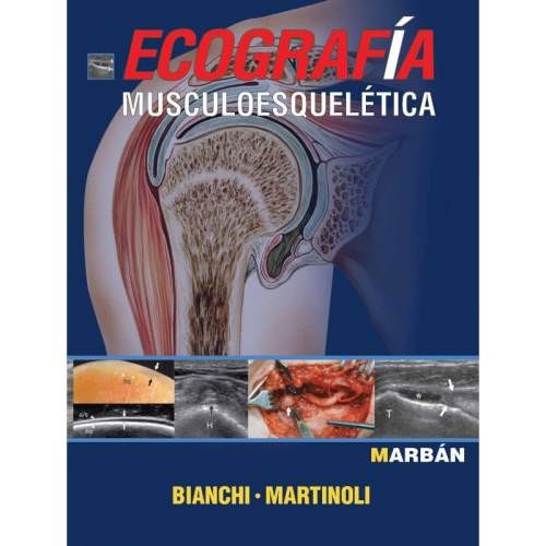 ECOGRAFIA MUSCULOESQUELETICA