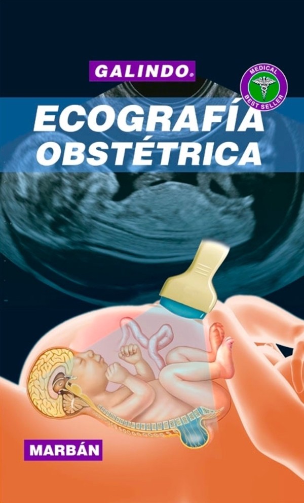 Ecografía Obstétrica