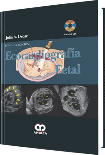 Drose. Ecocardiografía Fetal