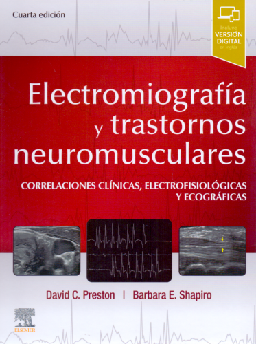 Electromiografía y trastornos neuromusculares