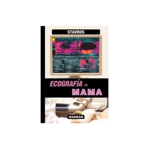 ECOGRAFIA DE MAMA