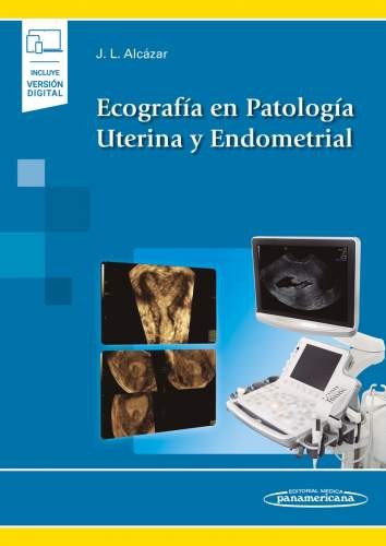 Ecografía en Patología Uterina y Endometrial