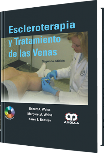 Escleroterapia y Tratamiento de las venas,