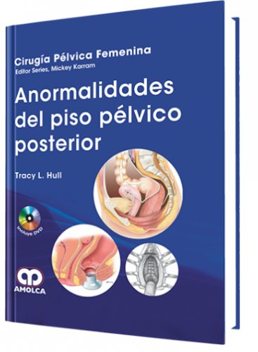 Anormalidades del Piso Pélvico Posterior