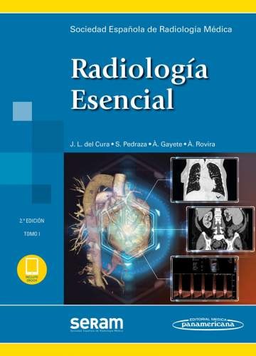 SERAM RADIOLOGIA ESENCIAL (2 TOMOS). INCLUYE SITIO WEB 2da ED 2019