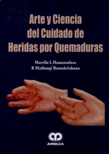 Arte y Ciencia del Cuidado de Heridas por Quemaduras