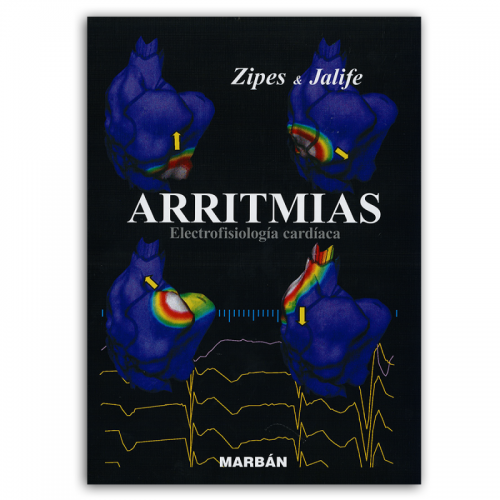 ARRITMIAS