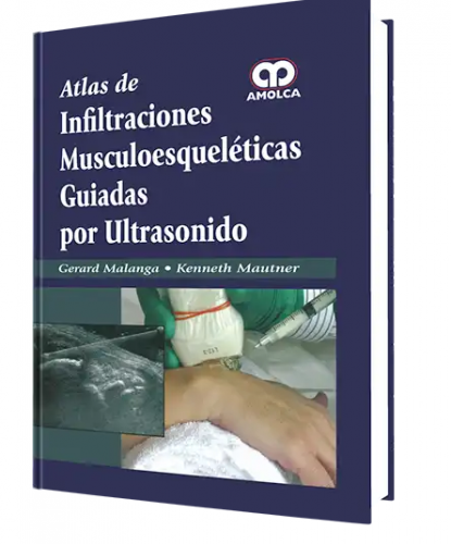 Atlas de Infiltraciones Muscoloesqueléticas Guiadas por Ults.