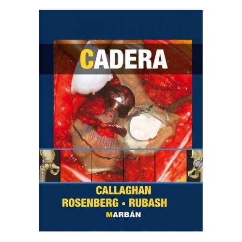CADERA TAPA DURA