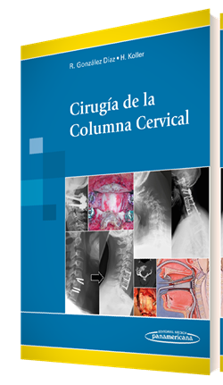 CIRUGIA DE LA COLUMNA CERVICAL